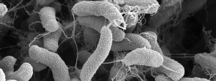 Vibrio cholerae. Raster-Elektronenmikroskopie. Maßstab = 1 µm. Quelle: Muhsin Özel, Gudrun Holland (2002)